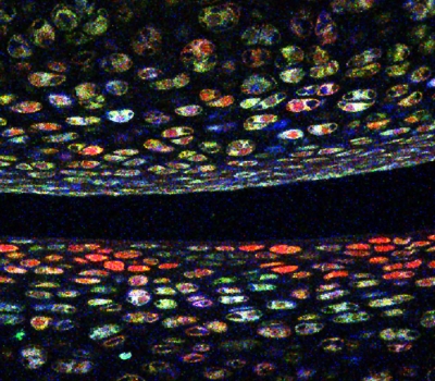 Colorful clones track stem cells